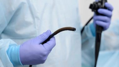 À quel âge faut-il faire sa première coloscopie ?