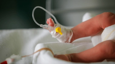 Inde : une deuxième tête retirée du ventre d'un bébé