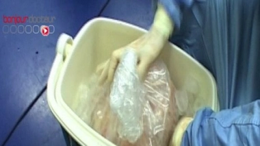 Pourquoi certaines greffes sont-elles impossibles ?