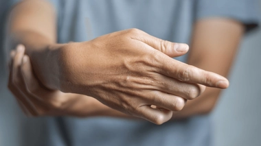 La maladie de Dupuytren entraîne une rigidité et un repli des doigts