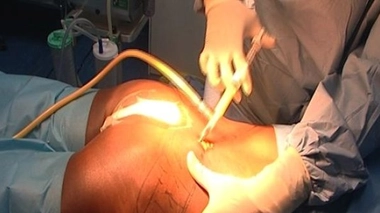 Ch@t : Avoir de belles fesses