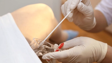 À quel âge faut-il commencer à faire des frottis ?