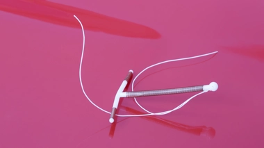 Stérilet en cuivre ou à la progestérone : quelles différences ?