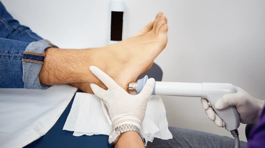 Les ondes de choc fonctionnent-elles vraiment contre les épines calcanéennes ?