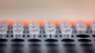 Le séquençage du virus est important pour contrôler l'épidémie  (photo d'illustration)