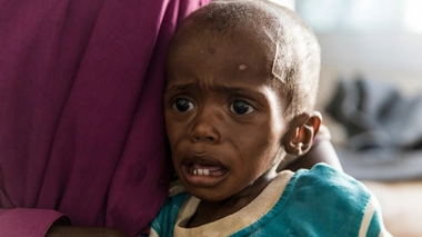 A Madagascar, la malnutrition des enfants pourrait quadrupler dans les prochains mois (Image d'illustration)