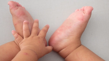 Les nouveau-nés marocains qui porteraient les deux organes (féminin et masculin) seront enregistrés comme enfants nés bisexués.