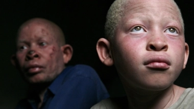 Un albinos et son père à Dar Es Salaam, en Tanzanie (photo d'illustration)