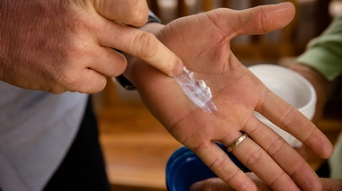 Le soleil est le pire ennemi des personnes atteintes d'albinisme (photo d'illustration)