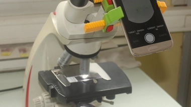 Au Cameroun, une nouvelle application facilite le diagnostic du paludisme