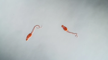 La bilharziose est provoquée par des vers parasites appelés schistosomes (photo d'illustration)