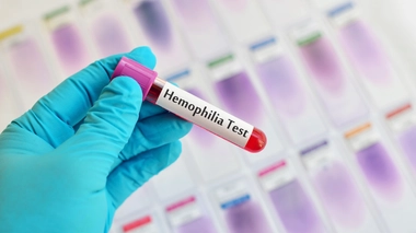 80% des hémophiles n'ont pas accès aux soins dont ils ont besoin (Image d'illustration)