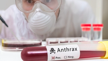 Deux personnes sont mortes de l'anthrax au Burkina Faso (Image d'illustration)