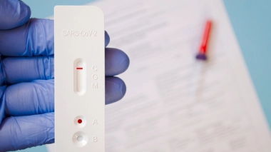 Les tests antigéniques sont disponibles à Libreville (image d'illustration)