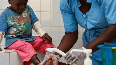 L'ulcère de Buluri peut aussi toucher les enfants