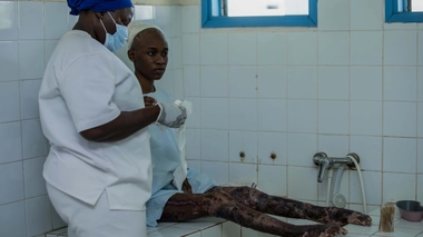 La lèpre se manifeste par des lésions cutanées