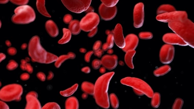 En Afrique, les femmes sont particulièrement sensibles à l'anémie (image d'illustration)