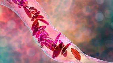 La drépanocytose est très répandue en RDC (photo d'illustration)