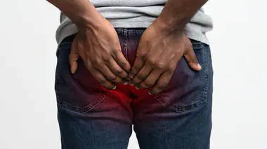 Les pathologies anales peuvent toucher tout le monde ! (Illustration)