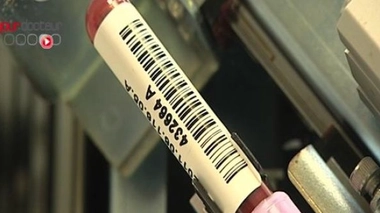 Le dépistage généralisé du sida trop peu efficace