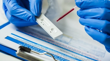 Un scientifique en train de réaliser un test rapide du Covid-19 (photo d'illustration)