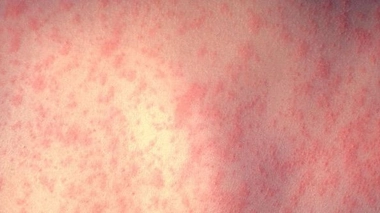 Image d'illustration.