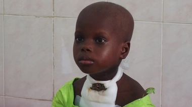 Le cancer touche beaucoup d'enfants au Cameroun (Illustration)