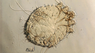 Voici le parasite à l'origine de la gale