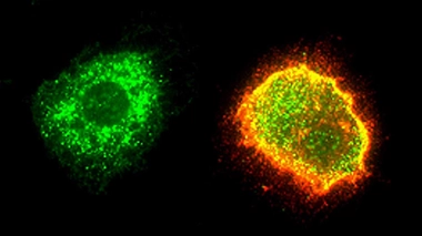 Macrophage humain infecté par le virus Lassa