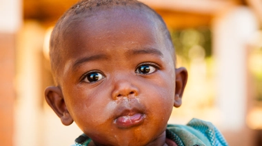 Non traité, le paludisme peut évoluer vers une forme cérébrale grave suivie par la mort (Illustration)
