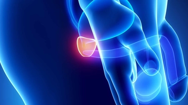 Le cancer de la prostate menace les hommes de plus de 45 ans (Illustration)