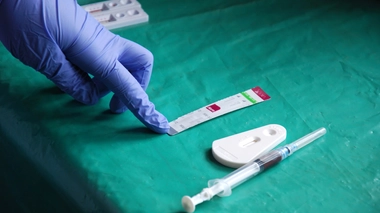 Le Cameroun accélère dans la prise en charge du VIH / Sida (Illustration)