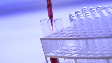 Les centres de dépistage du VIH ont augmenté au Maroc (Illustration)