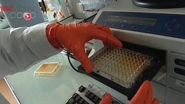 Enfin des espoirs de traitements contre le lupus