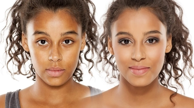 La dépigmentation volontaire est un facteur de risque pour plusieurs pathologies