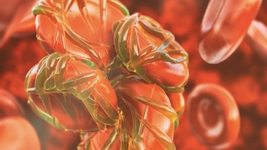 La thrombose veineuse