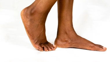 Plaies chroniques du pied