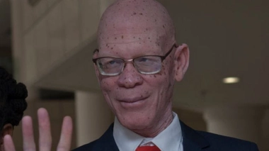 Overstone Kondowe est le conseiller spécial sur l'albinisme du président malawite Lazarus Chakwera.