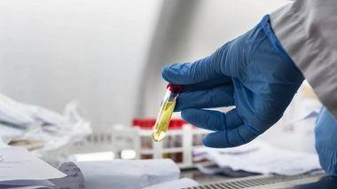 Le variant Omicron a été détecté au Sénégal 