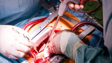 Cette greffe est la première du genre