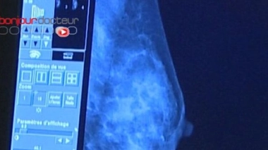Prédire l'évolution du cancer du sein grâce à un logiciel