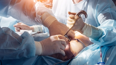 La reconstruction mammaire par autogreffe est une technique controversée aux yeux de certains professionnels de la santé