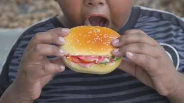En Afrique, beaucoup d'enfants sont en surpoids 
