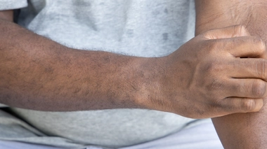 Tous les types de peau peuvent être concernés par des démangeaisons