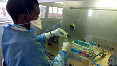 Le FujiLAM pourrait simplifier le diagnostic de la tuberculose 