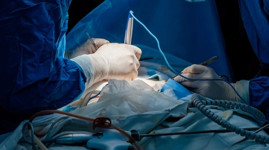 Un chirurgien en train de réaliser une incision