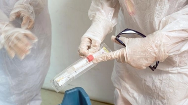 Le test virologique PCR sert au dépistage du Covid-19. Ses résultats sont obtenus sous 48 heures.