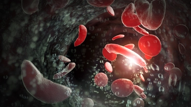 Comment savoir si j'ai la drépanocytose ?