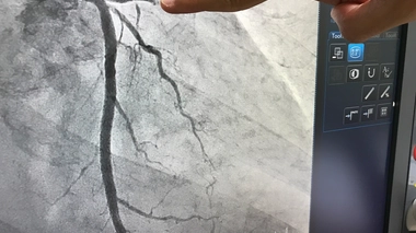 L'angiographie et le cathétérisme cardiaque sont désormais possibles à Douala