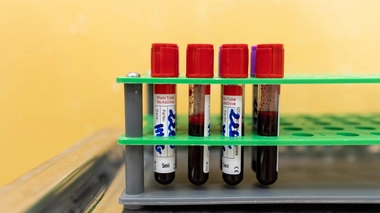 Le Sénégal se tourne vers les réseaux sociaux pour encourager le don de sang